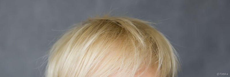 Mi melena rubia tiene reflejos verdes, ¿qué hago?