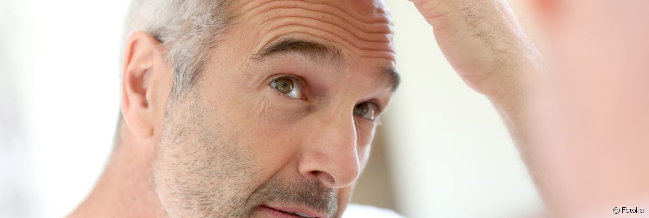 Hombre: ¿Cómo prevenir la caída de cabello?